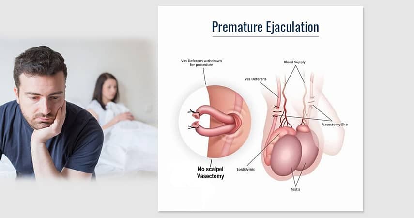 Premature Ejaculation and Causes behind It