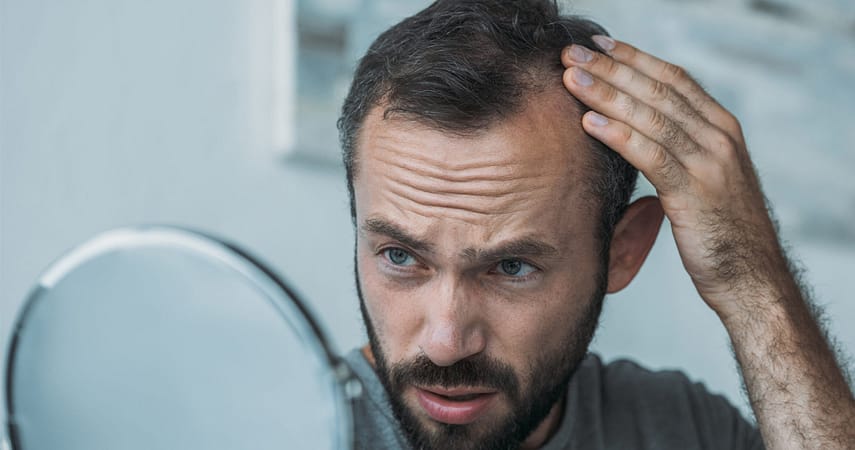 Causes & Effective Treatment Options for Hair Loss in Men